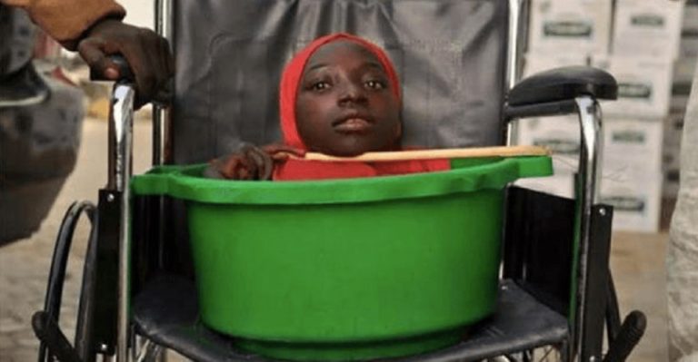 limbless-teen-who-lived-her-entire-life-inside-a-plastic-bucket-passes-away-at-19