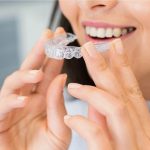 everything-you-should-know-about-invisalign